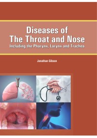 Diseases of the Throat and Nose : Including the Pharynx, Larynx and Trachea