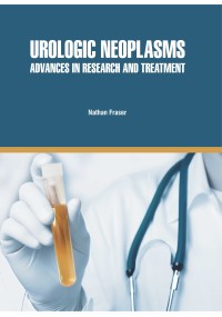 Urologic Neoplasms: Advances in Research and Treatment