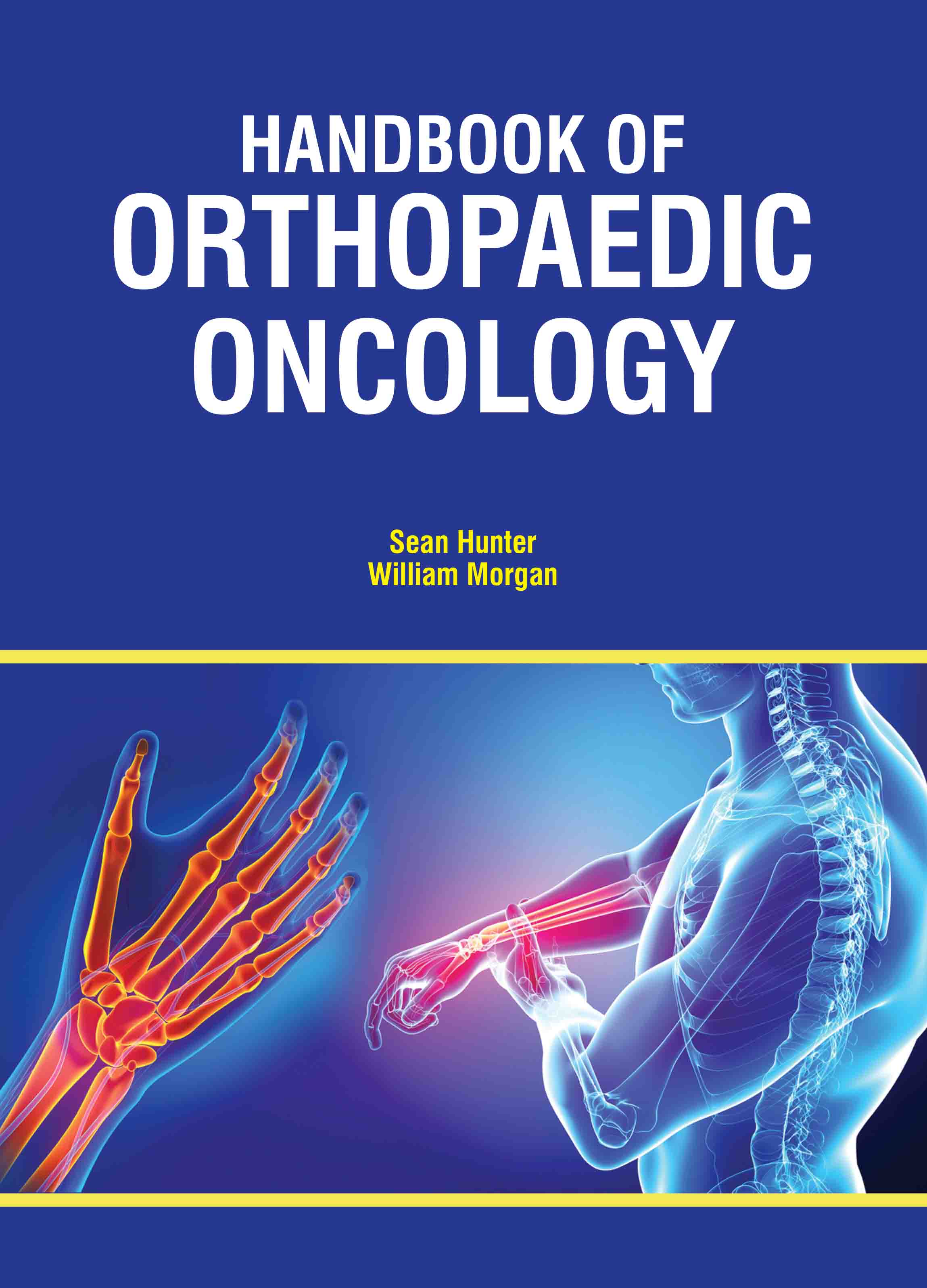 Handbook of Orthopaedic Oncology