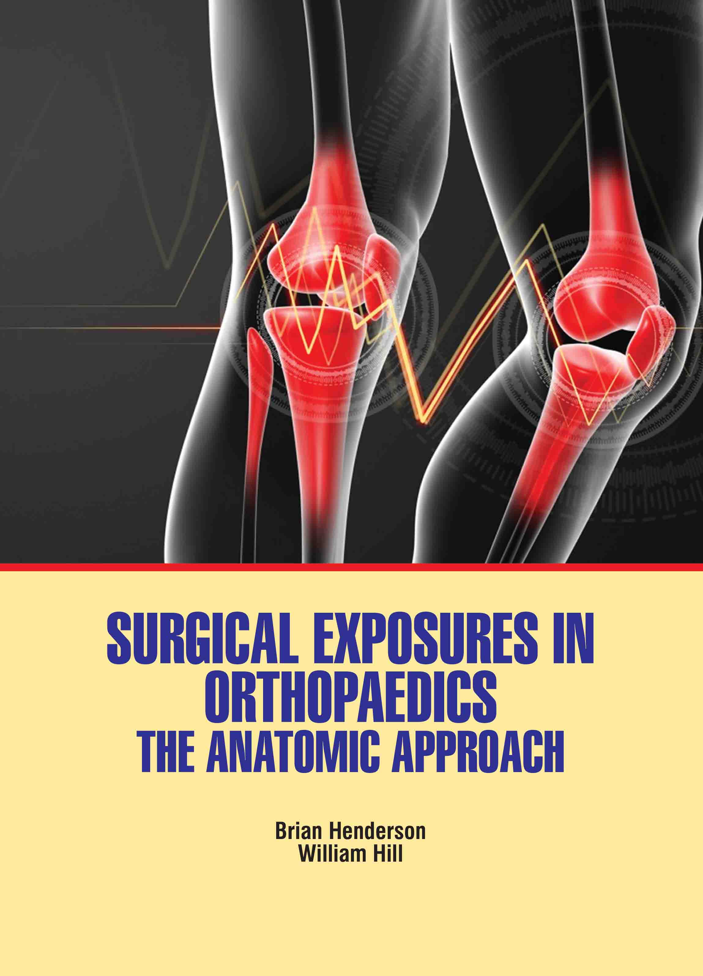 Surgical Exposures in Orthopaedics: The Anatomic Approach