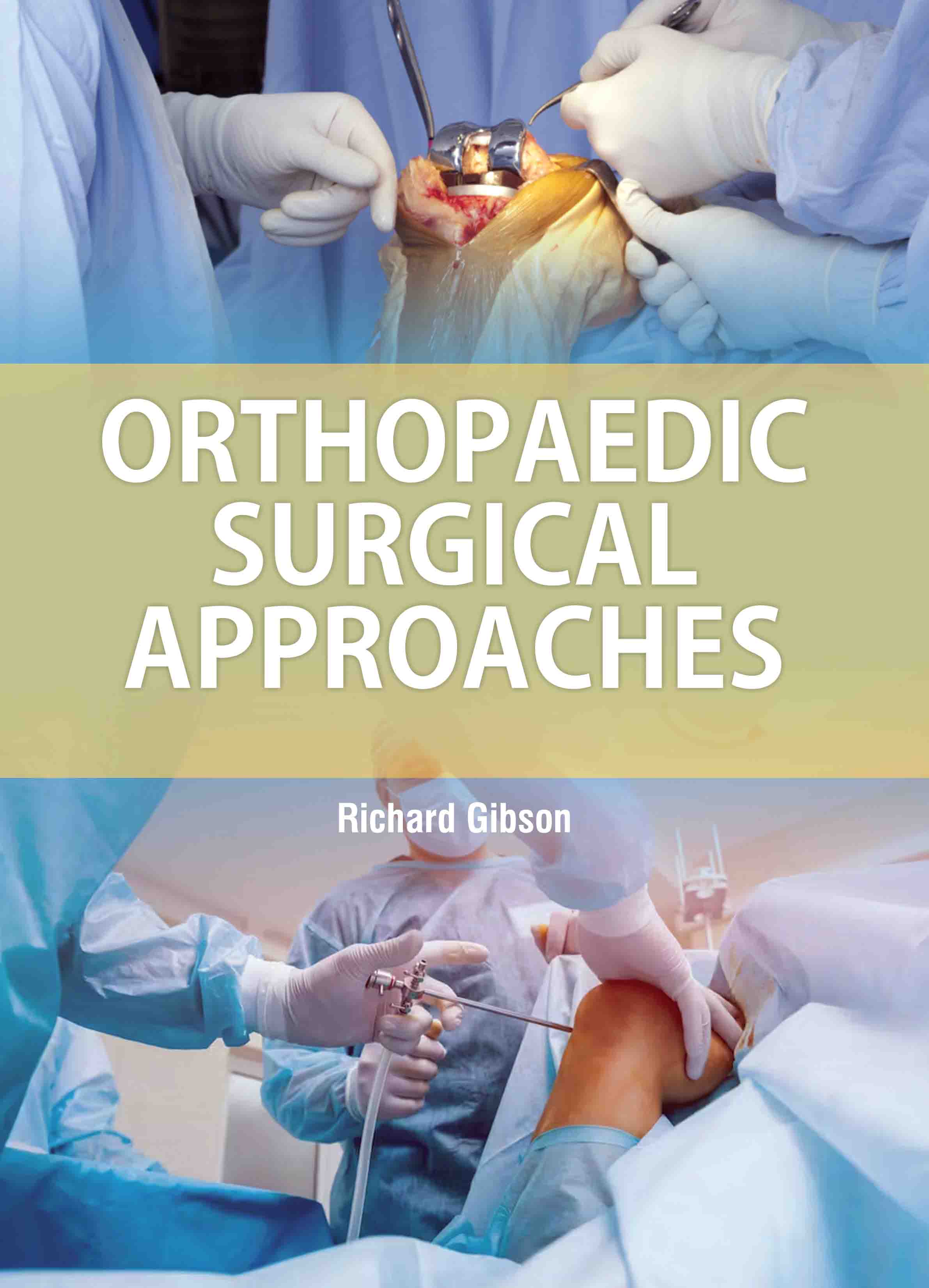 Orthopaedic Surgical Approaches