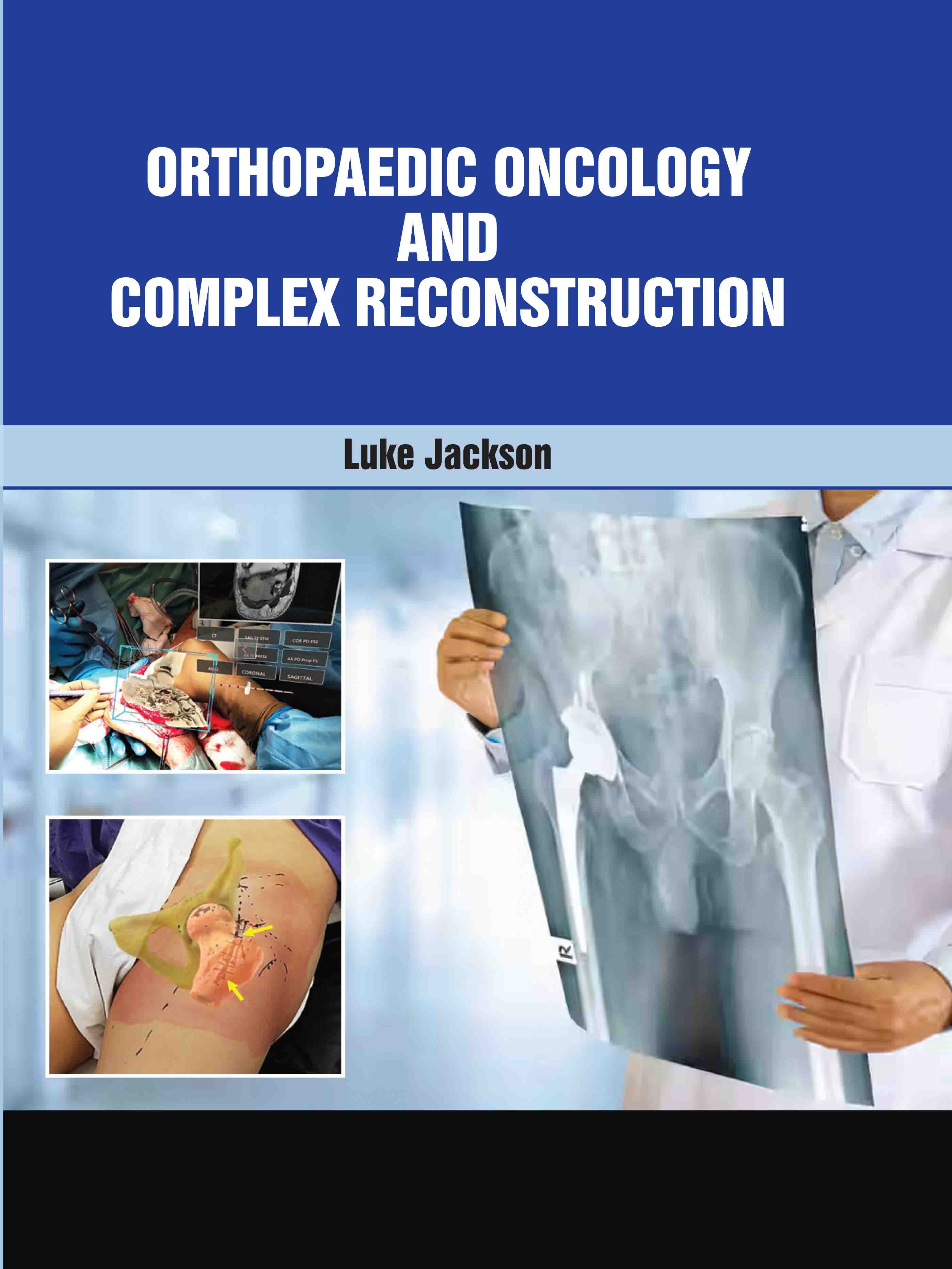 Orthopaedic Oncology and Complex Reconstruction