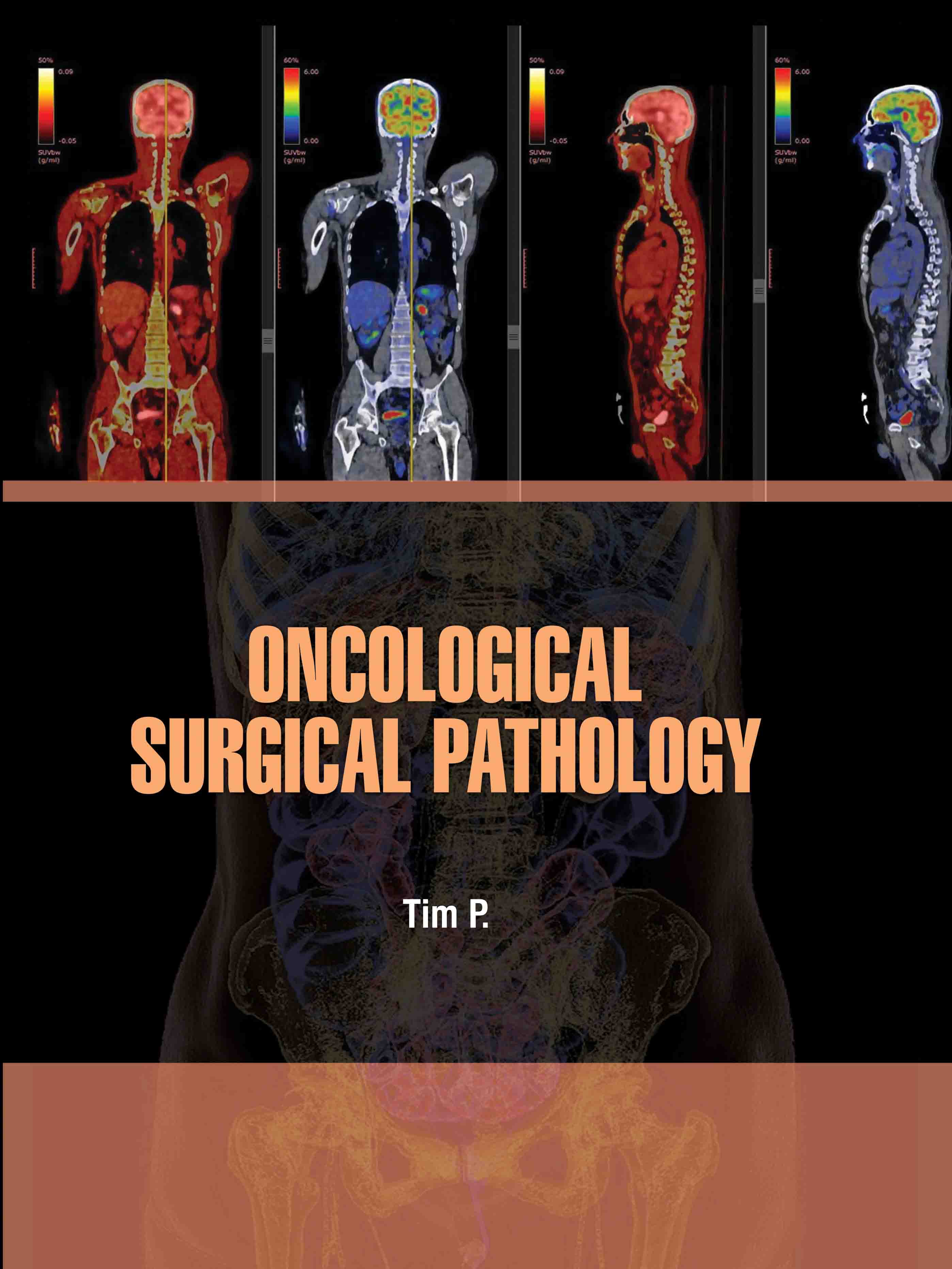 Oncological Surgical Pathology cover image