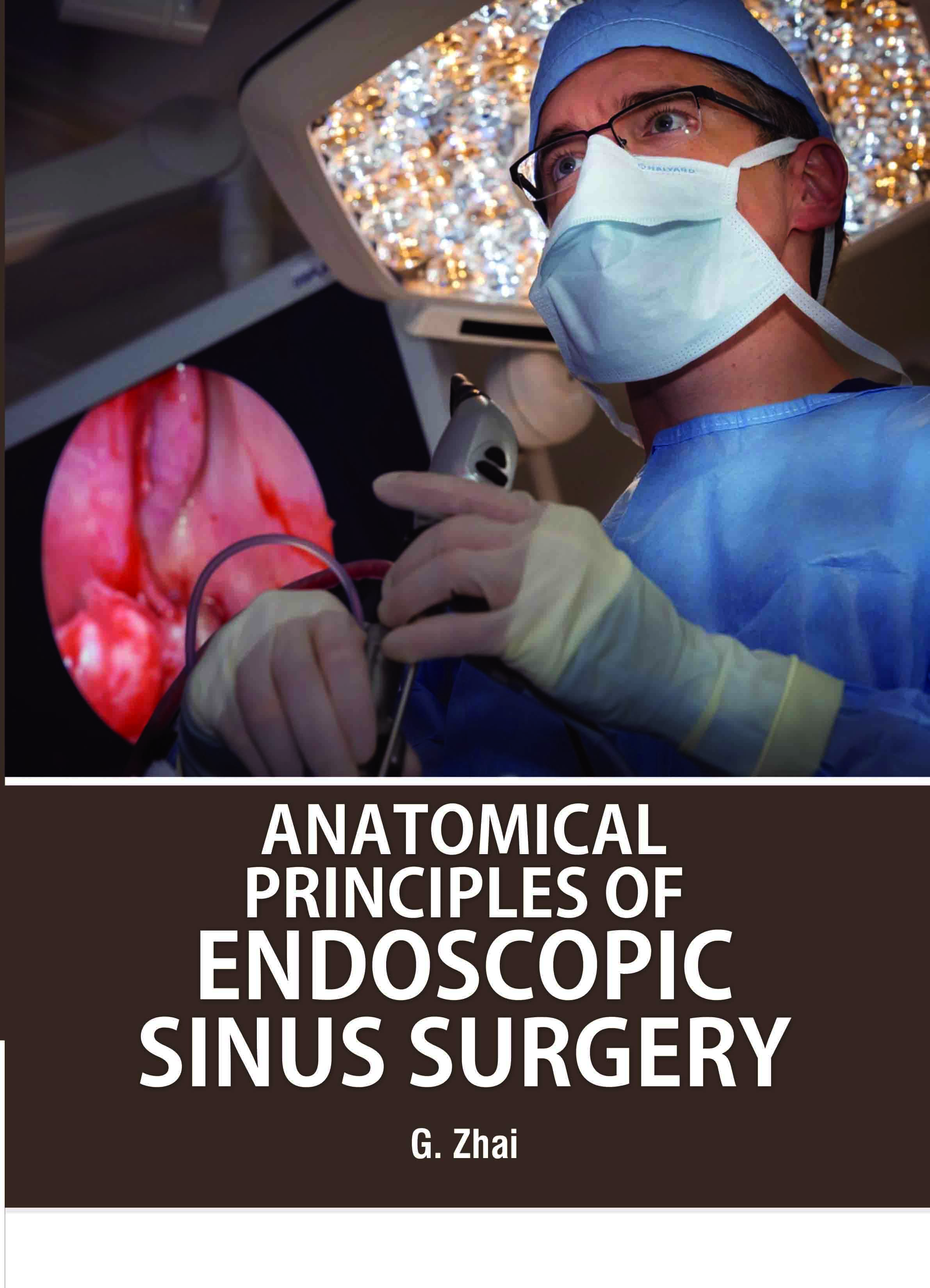 Anatomical Principles of Endoscopic Sinus Surgery cover image