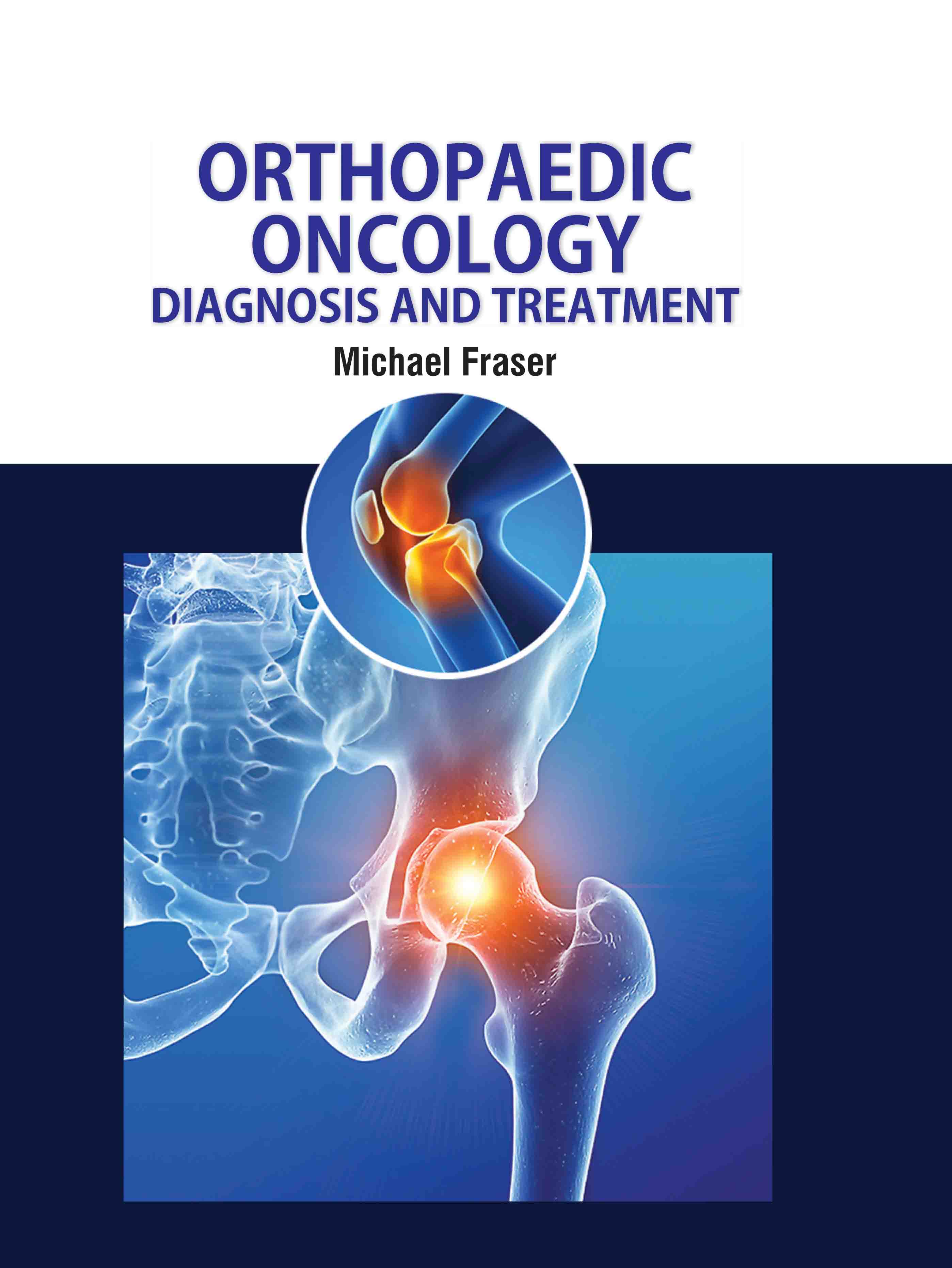 Orthopaedic Oncology: Diagnosis and Treatment