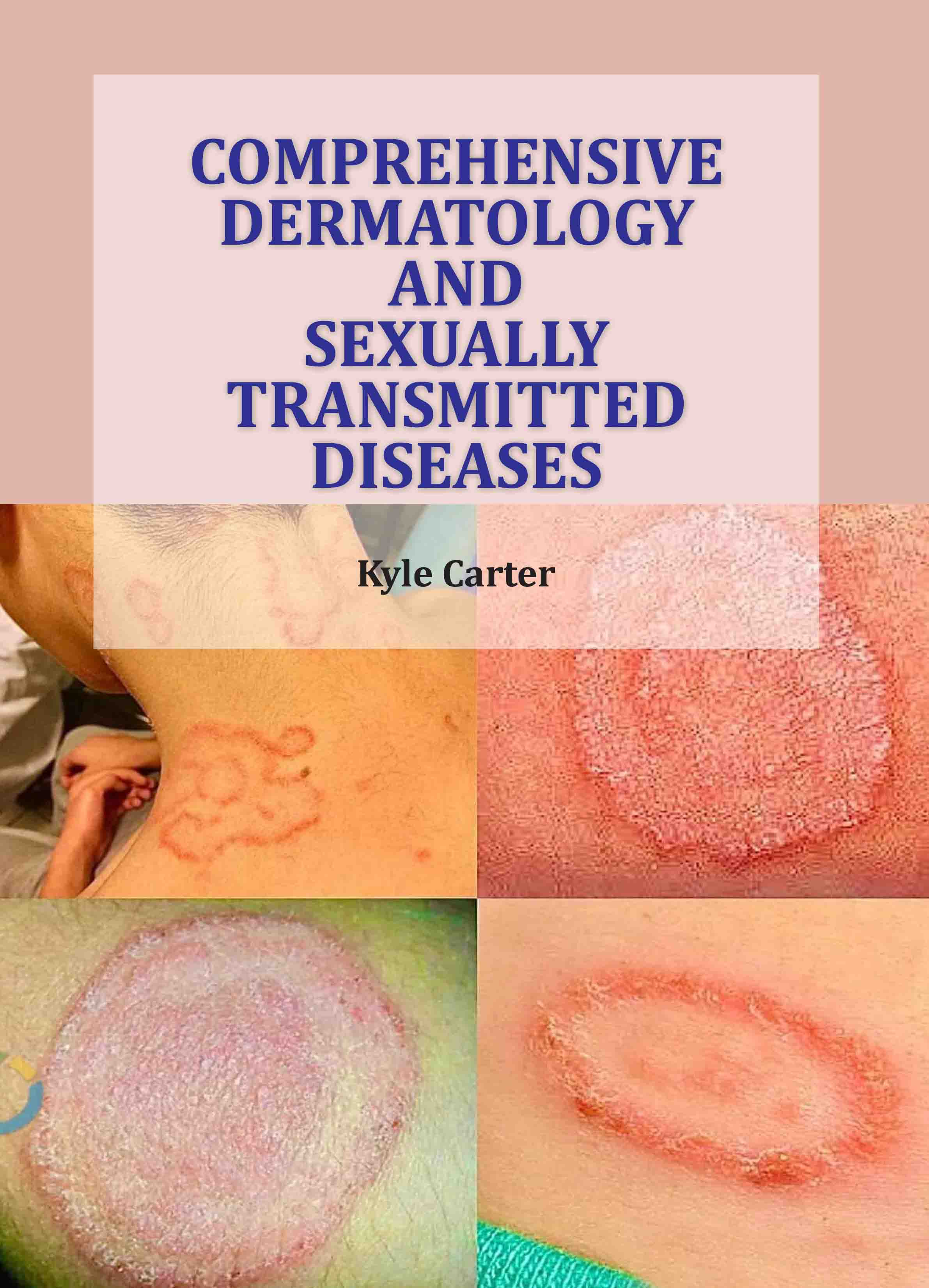 Comprehensive Dermatology And Sexually Transmitted Diseases