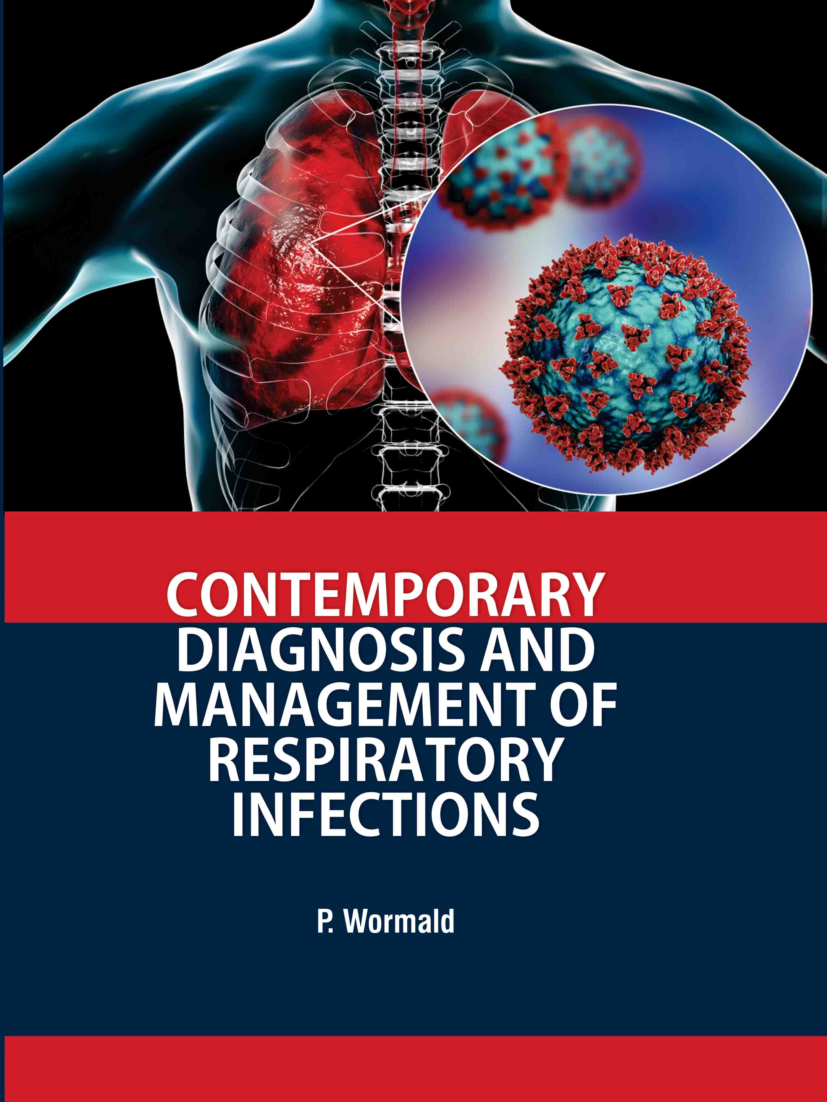 Contemporary Diagnosis and Management of Respiratory Infections 