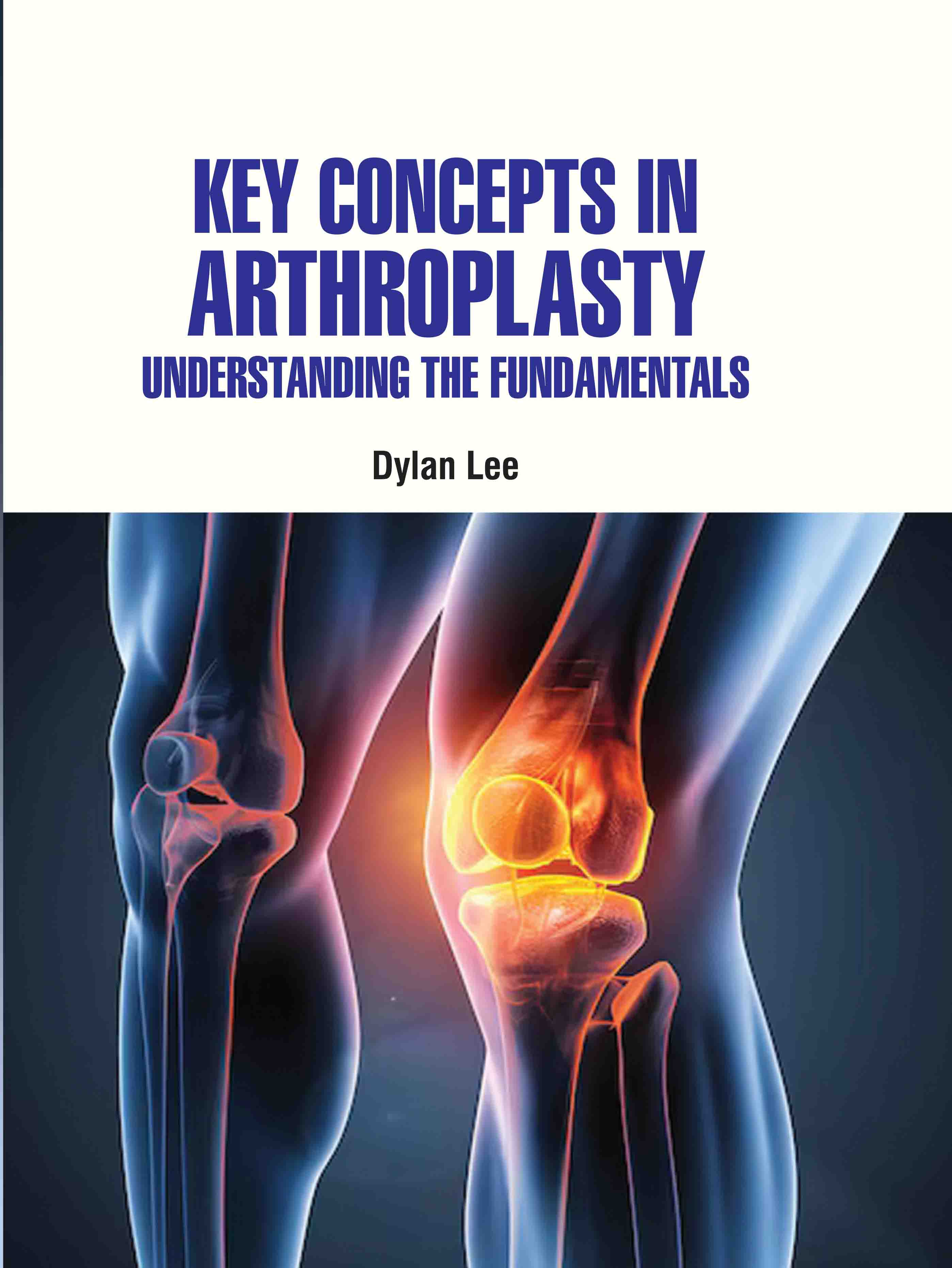 Key Concepts in Arthroplasty: Understanding the Fundamentals