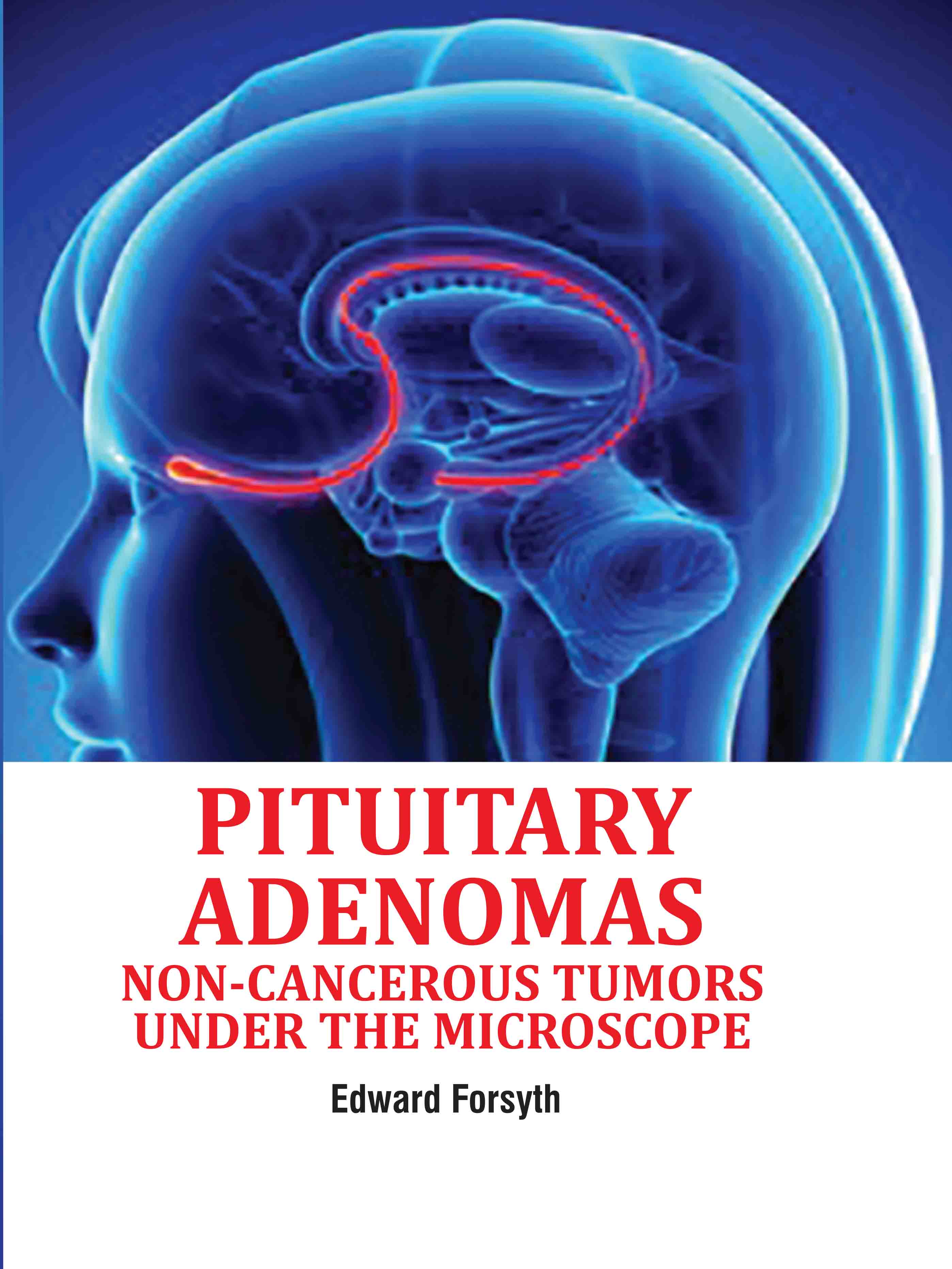 Pituitary Adenomas: Non-Cancerous Tumors Under the Microscope